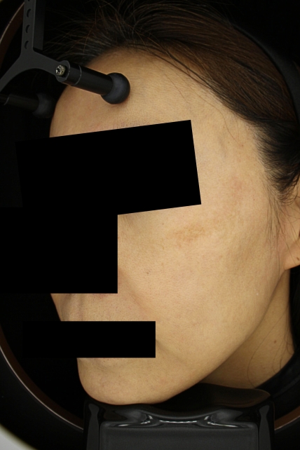 치료후기 이미지