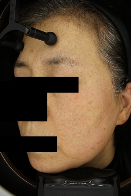 치료후기 이미지