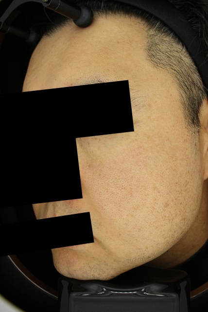 치료후기 이미지