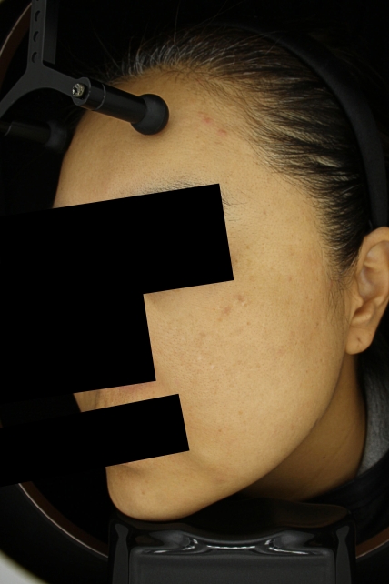 치료후기 이미지