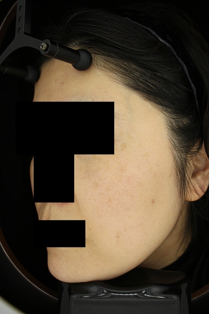 치료후기 이미지