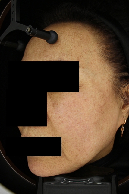 치료후기 이미지