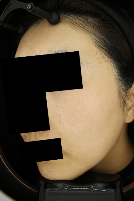 치료후기 이미지