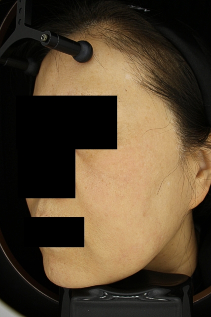 치료후기 이미지