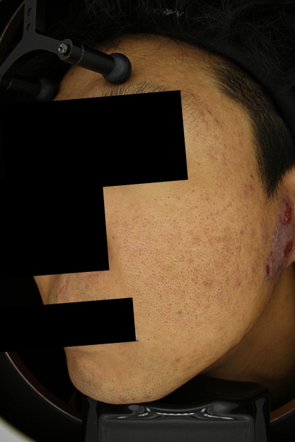 치료후기 이미지