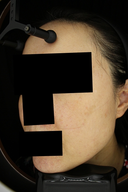 치료후기 이미지