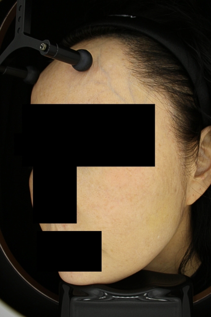 치료후기 이미지