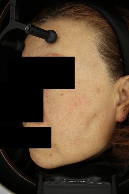 치료후기 이미지