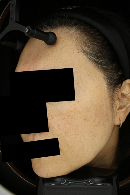 치료후기 이미지