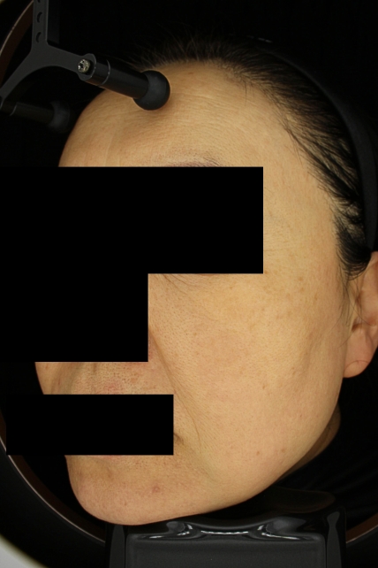 치료후기 이미지