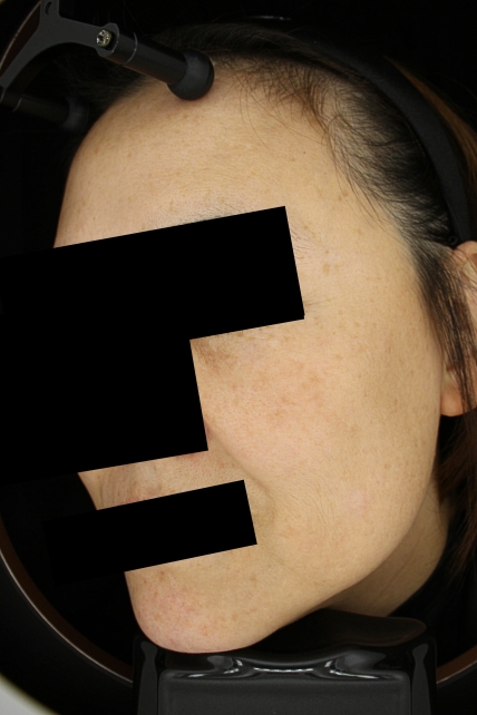 치료후기 이미지