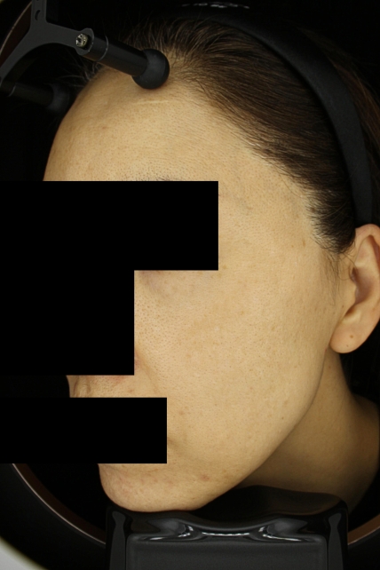 치료후기 이미지