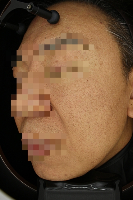 치료후기 이미지