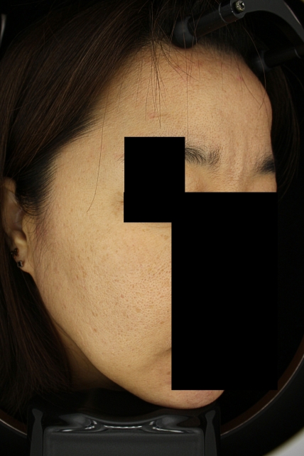 치료후기 이미지