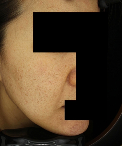 치료후기 이미지