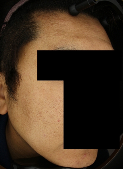 치료후기 이미지