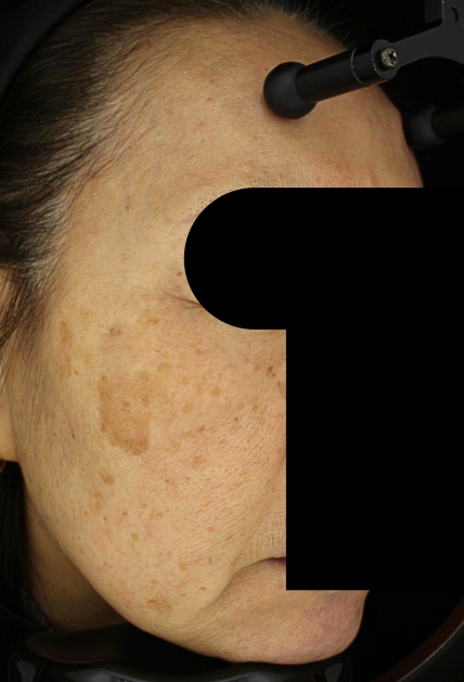 치료후기 이미지