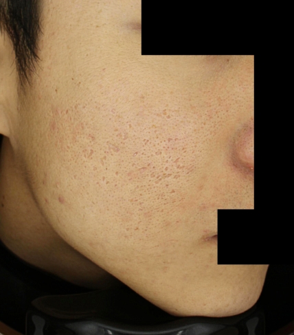 치료후기 이미지