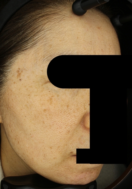 치료후기 이미지