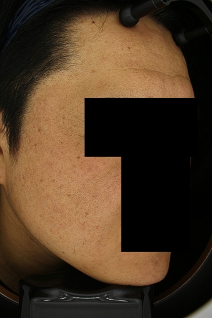 치료후기 이미지