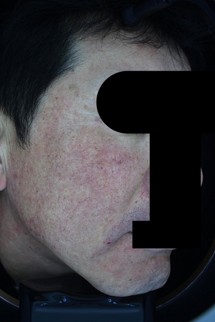 치료후기 이미지