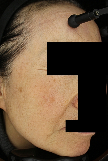 치료후기 이미지