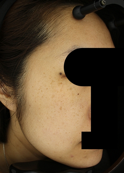 치료후기 이미지