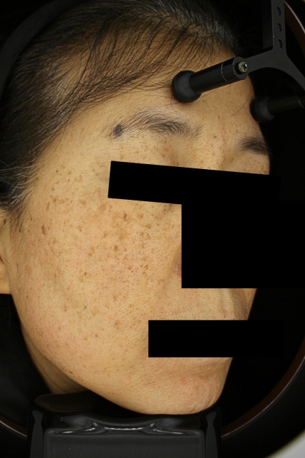 치료후기 이미지