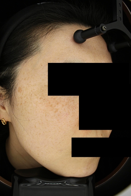 치료후기 이미지