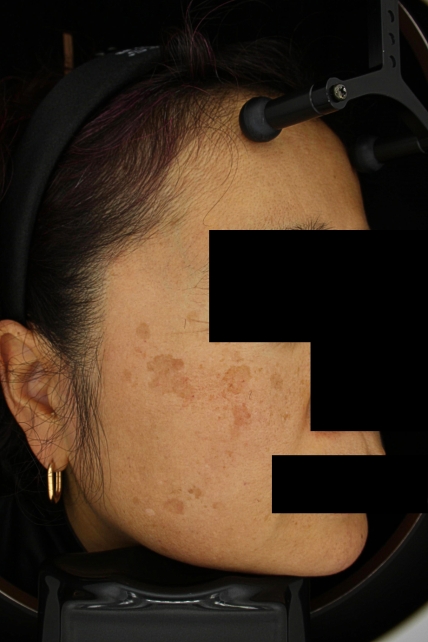 치료후기 이미지