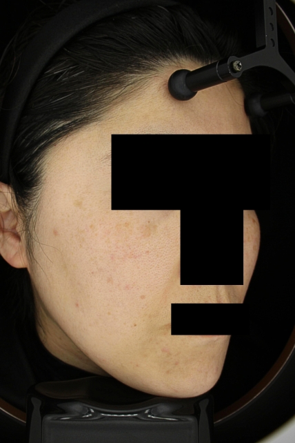 치료후기 이미지