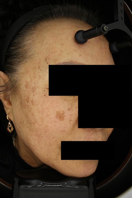 치료후기 이미지