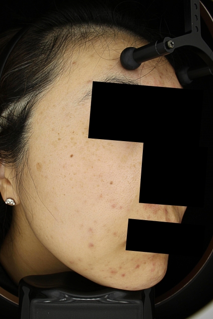 치료후기 이미지