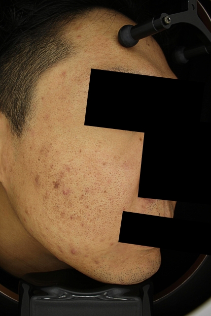 치료후기 이미지