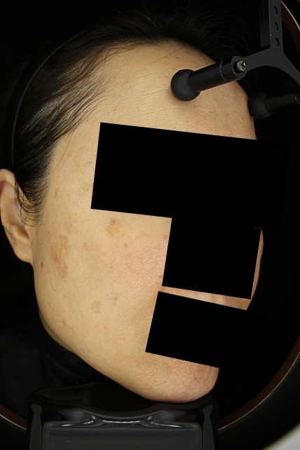 치료후기 이미지