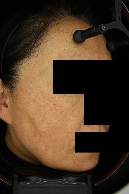 치료후기 이미지