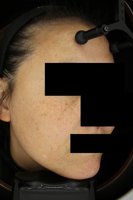 치료후기 이미지