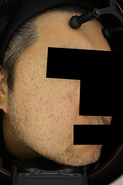 치료후기 이미지