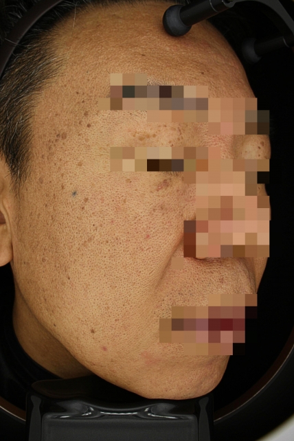 치료후기 이미지