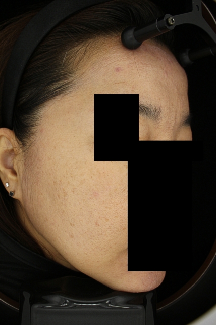 치료후기 이미지