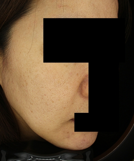 치료후기 이미지