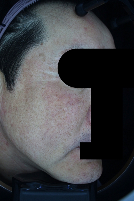 치료후기 이미지