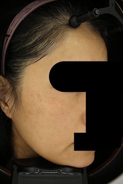 치료후기 이미지