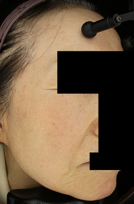 치료후기 이미지