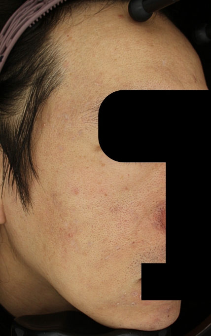 치료후기 이미지