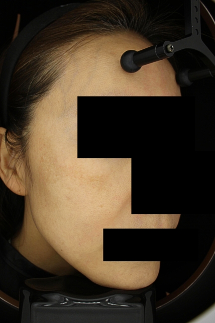 치료후기 이미지