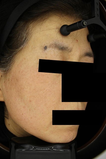 치료후기 이미지