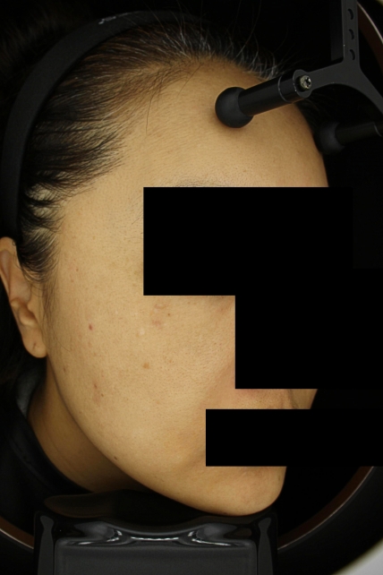 치료후기 이미지