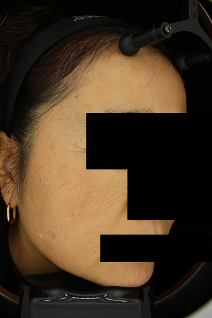 치료후기 이미지