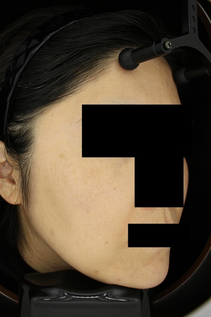 치료후기 이미지